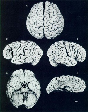 Einstein's brain